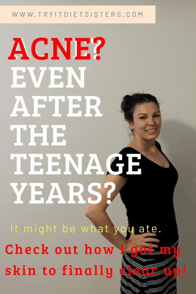 A woman posing with clear skin. with title: acne even after the teenage years? it might be what you ate. check out how I got my skin to finally clear up